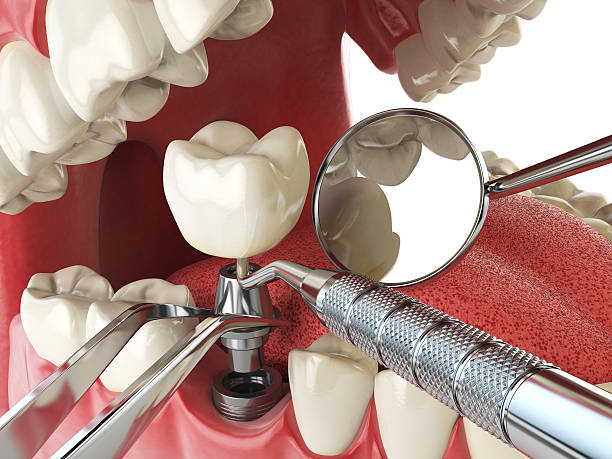 Best Emergency Treatment for Toothache in Norwood, NY